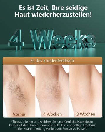 Пристрій для епіляції IPL з IGBT-технологією: швидка та ефективна епіляція для жінок та чоловіків. Підходить для обличчя, зони бікіні, тіла, ніг та під пахвами. Максимальна енергія 21J, 600-1200NM.