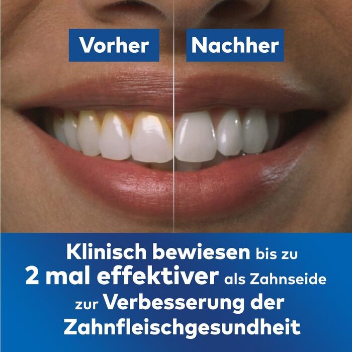 Waterpik Advanced Waterflosser: бездротовий іригатор, Testsieger 2024, технологія Precision Pulse, 4 насадки, 3 режими, для догляду за зубами та яснами