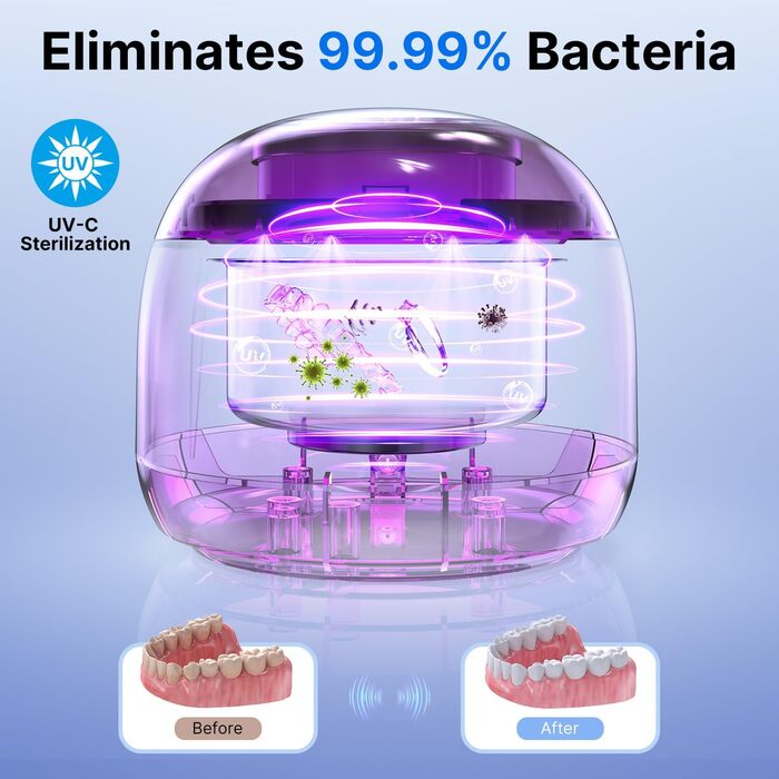 Ультразвукова мийка для ювелірних виробів та зубних протезів, 45000 Гц, 25 Вт, 200 мл, чорна