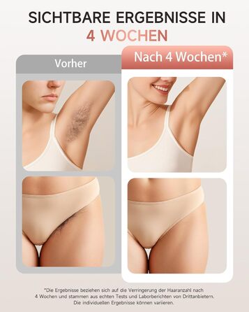 IPL пристрій для епіляції Haarlosy: 999,900 імпульсів, 3 функції, 9 рівнів, для чоловіків та жінок, безболісна епіляція тіла, обличчя, бікіні