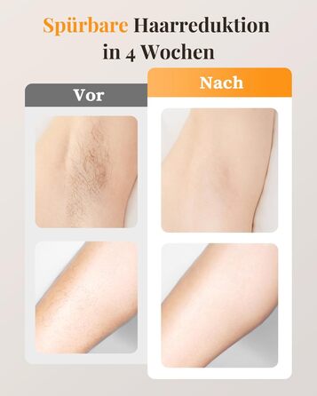 Пристрій для епіляції IPL з охолодженням, 9 рівнів потужності, 999900 імпульсів світла, безболісна епіляція вдома для обличчя, тіла, пахв та ніг (білий)