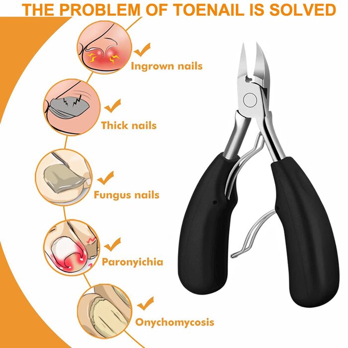 Набір професійних щипців для педикюру 12 шт. з нержавіючої сталі для вирізання врослих, товстих нігтів (чорний)