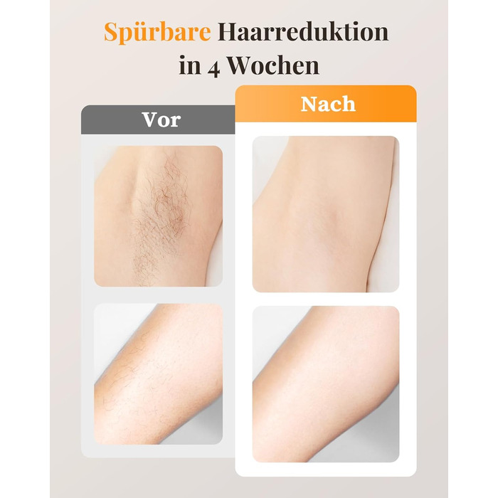 Пристрій для епіляції IPL з охолодженням, 9 рівнів потужності, 999900 імпульсів світла, безболісна епіляція вдома для обличчя, тіла, пахв та ніг (білий)