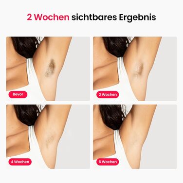 Прилад для епіляції IPL з потрійним імпульсом, 12 см², охолодження сапфіровим льодом, для жінок та чоловіків, 3°C, безболісна та довготривала епіляція вдома, для обличчя, зони бікіні та паху, блакитний