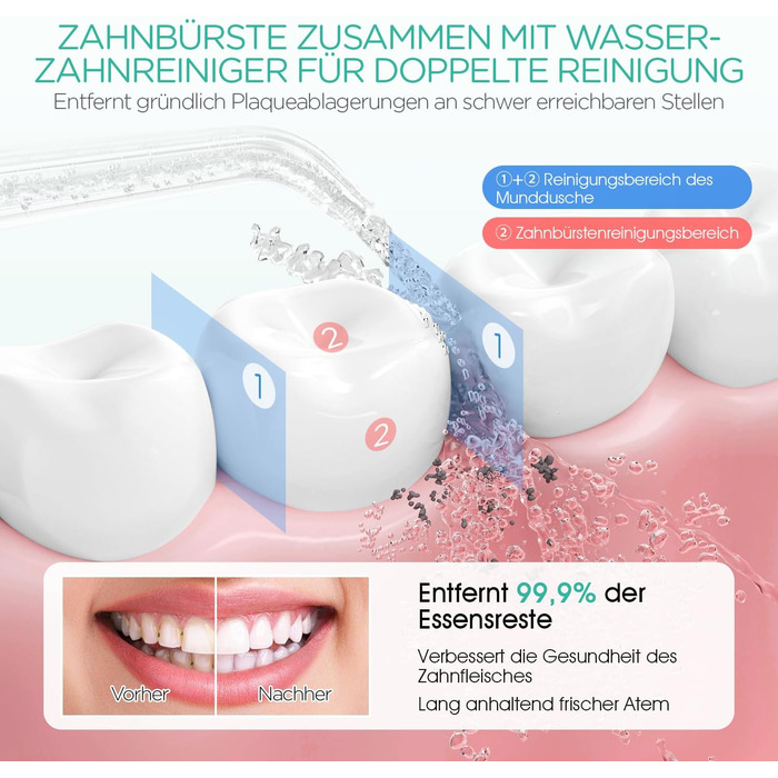 Електрична іригатор VOYOR-HEALTH Munddusche WF400: 3 режими, 4 насадки, водонепроникний, для догляду за зубами та яснами