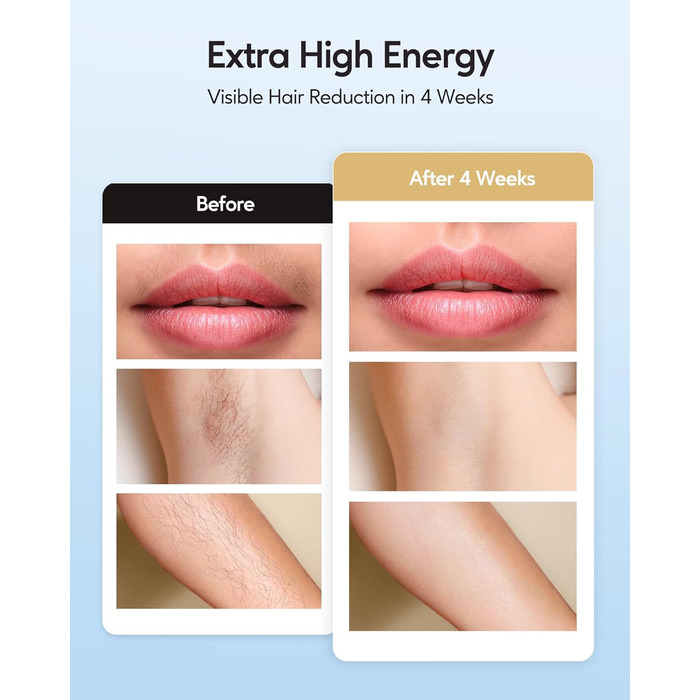 IPL пристрій для епіляції Innza з охолодженням, 999 999 імпульсів, 9 рівнів потужності, для обличчя, зони бікіні, тіла, рожеве золото