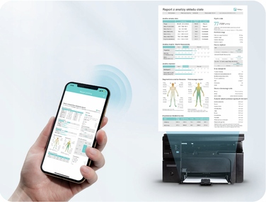 Аналітичні ваги для ванної кімнати, 8 електродів, білі — Визначення складу тіла, Bluetooth, Додаток, до 180 кг