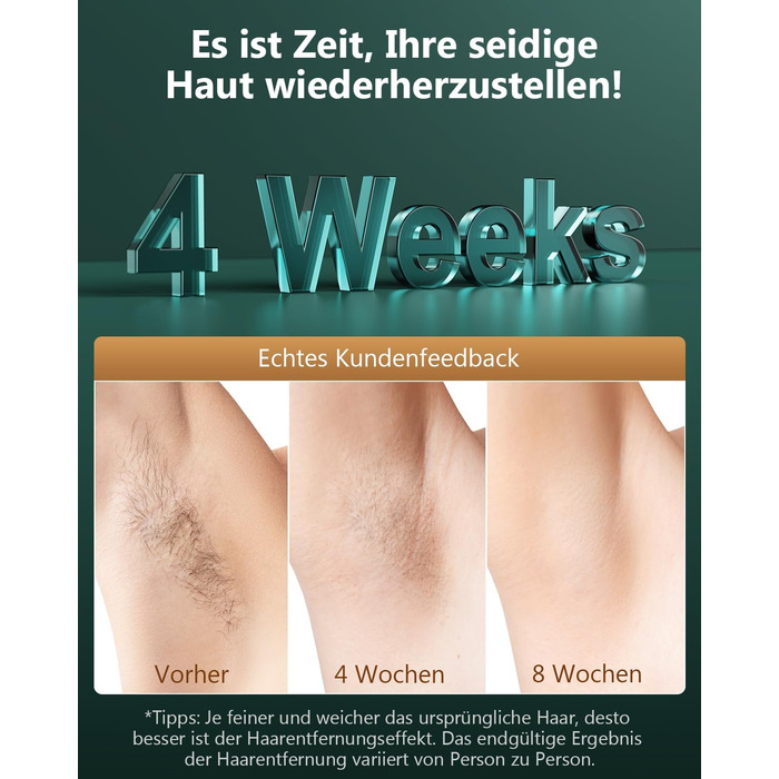 Пристрій для епіляції IPL з IGBT-технологією: швидка та ефективна епіляція для жінок та чоловіків. Підходить для обличчя, зони бікіні, тіла, ніг та під пахвами. Максимальна енергія 21J, 600-1200NM.