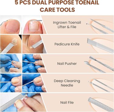 Кусачки для нігтів для літніх людей з товстими нігтями Zehennagelknipser: професійні кусачки з гострим вигнутим лезом та пилкою, нержавіюча сталь