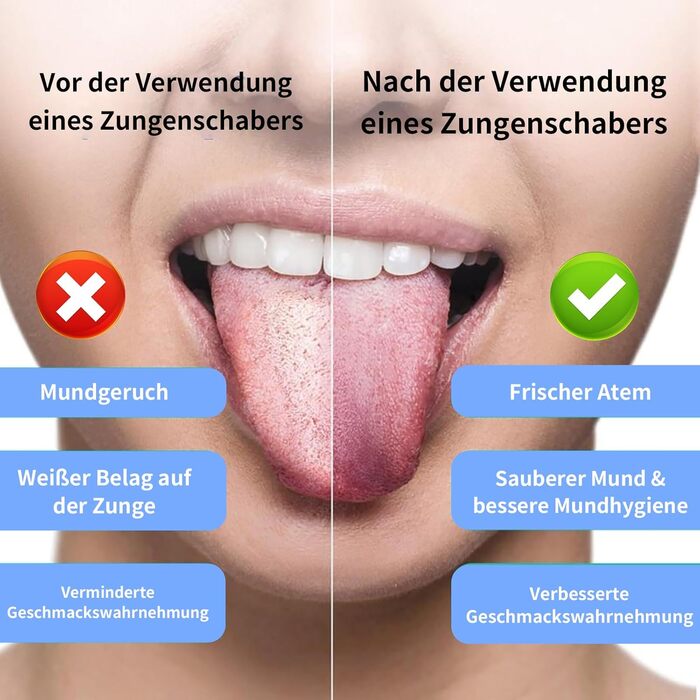 Електрична звукова зубна щітка JTF з очищувачем язика, 8 насадок, 5 режимів, Smart Memory, таймер 2 хв, IPX7, бездротова зарядка, для дорослих (блакитна) + очищувач язика