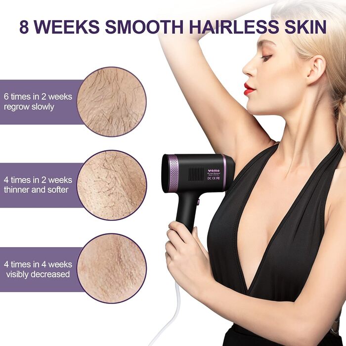 Пристрій для епіляції IPL з сапфіровим наконечником, охолодженням та 500 000 імпульсів світла. 2 насадки для обличчя, тіла, зони бікіні та пахв. Постійне видалення волосся. Violett